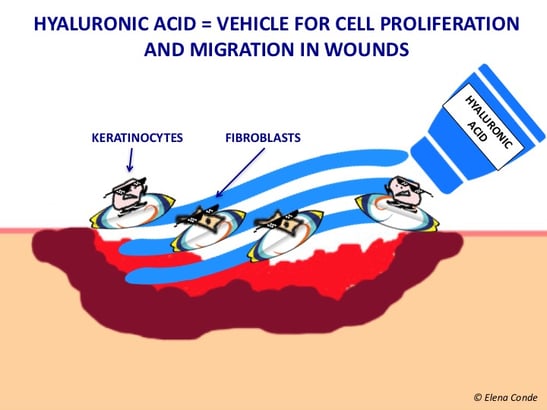 hyaluronic-acid-in-wounds